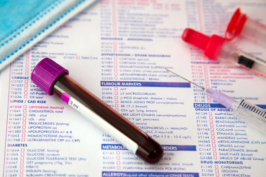 Labs Blood Work. Blood sample. blood analysis report